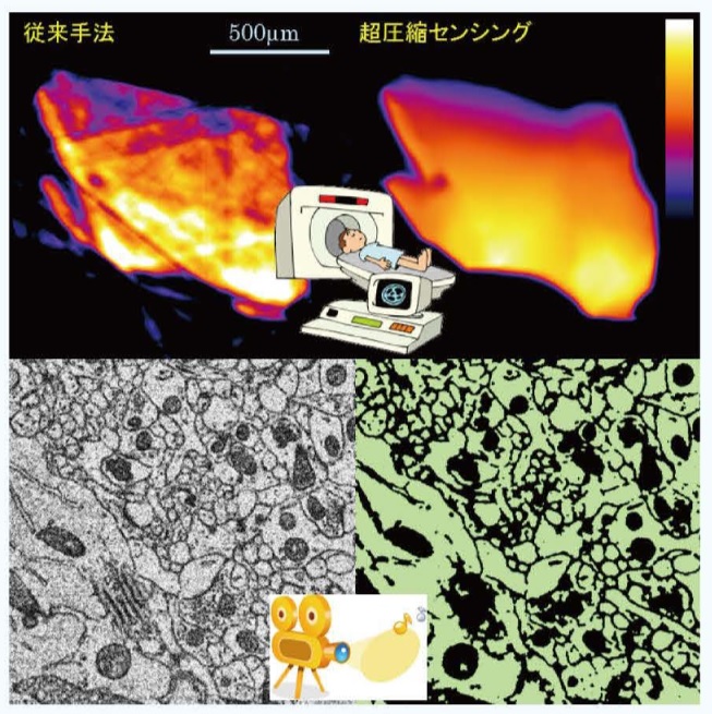 医療系画像処理の応用例
